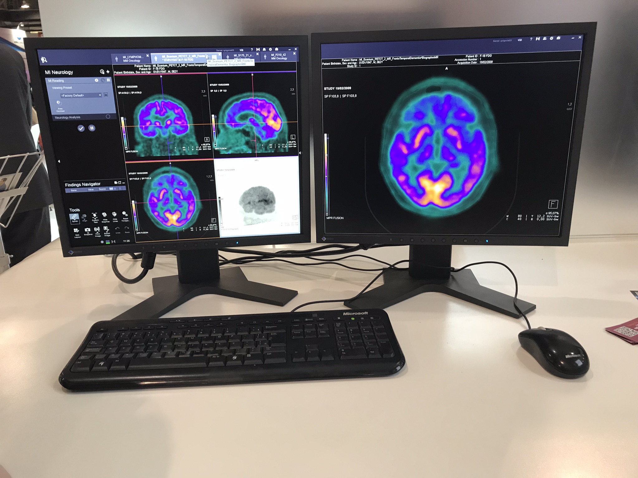 Pós processamento de Imagens em Ressonância Magnética