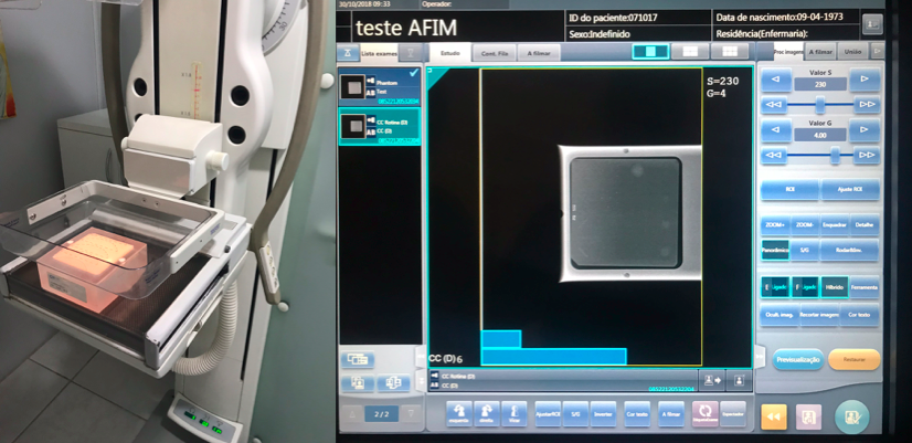 Controle de Qualidade em Mamografia