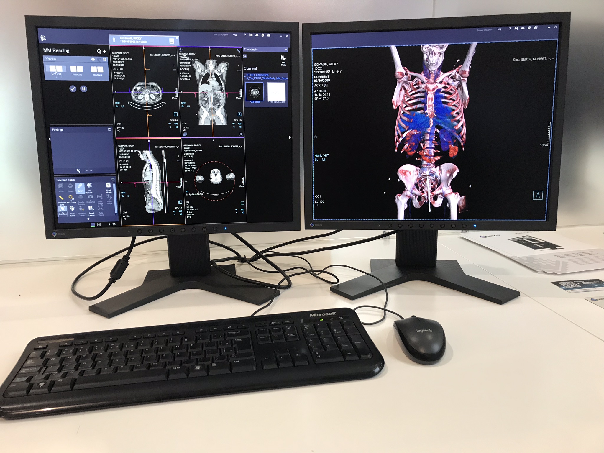 Pós processamento de Imagem em Tomografia Computadorizada